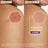 A-Derma Exomega Epithelial Ah Ultra-Repairing Anti-Scarring Cream 40 ml