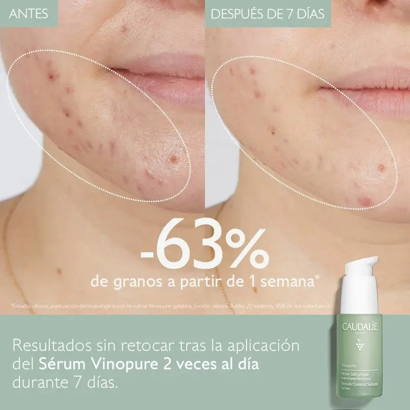 Caudalíe Vinopure Sérum salicylique anti-imperfections - 30 ml