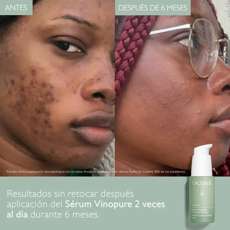 Caudalíe Vinopure Sérum salicylique anti-imperfections - 30 ml