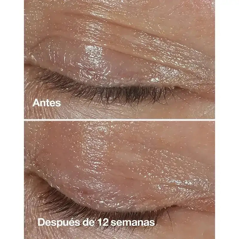 Clinique Smart Clinical Repair Crème anti-rides pour les yeux, 2x15 ml