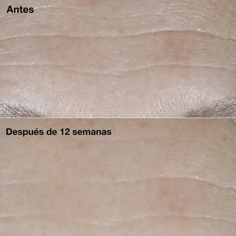 Clinique Smart Clinical Repair Anti-Ageing Cream SPF30, 50 ml