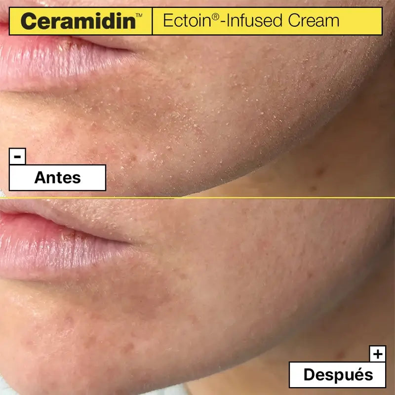 Jart+ Ceramidin Moisturising Facial Cream With Ectoin, 50 ml
