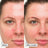 Gel-crème de traitement apaisant Dr. Jart+, 30 ml