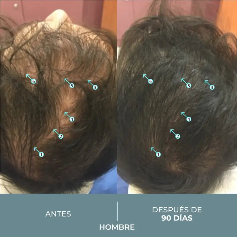Ds Laboratories Revita Sod Comprimés anti-chute, 30 pcs
