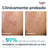 Eucerin Dermopure Peeling 10% Acides Hydroxylés, 40 ml