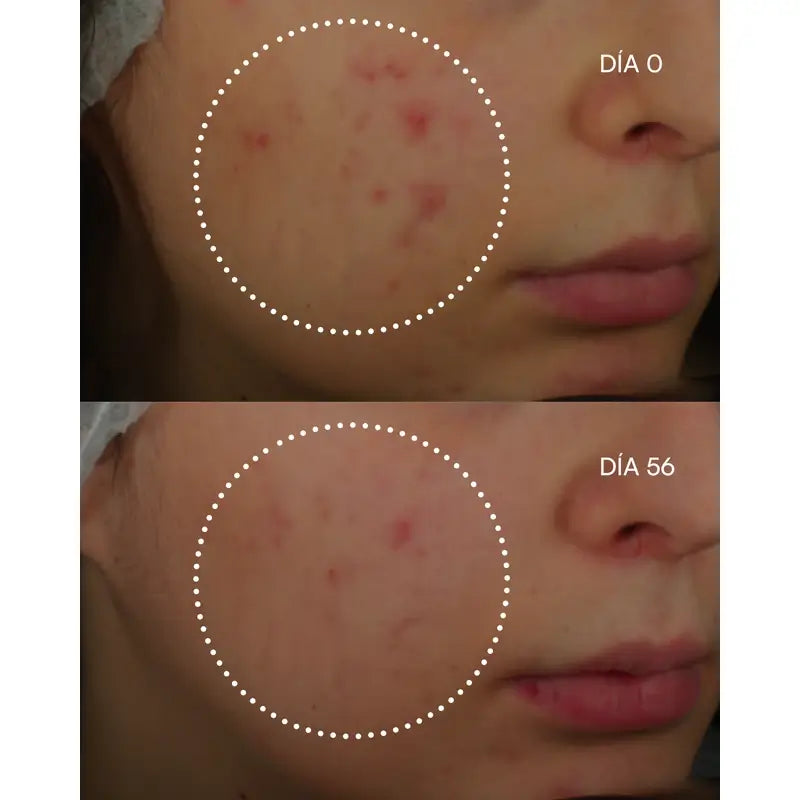 Gema Herrerías 1600 Retinal-Z Imperfections Serum, 30 ml