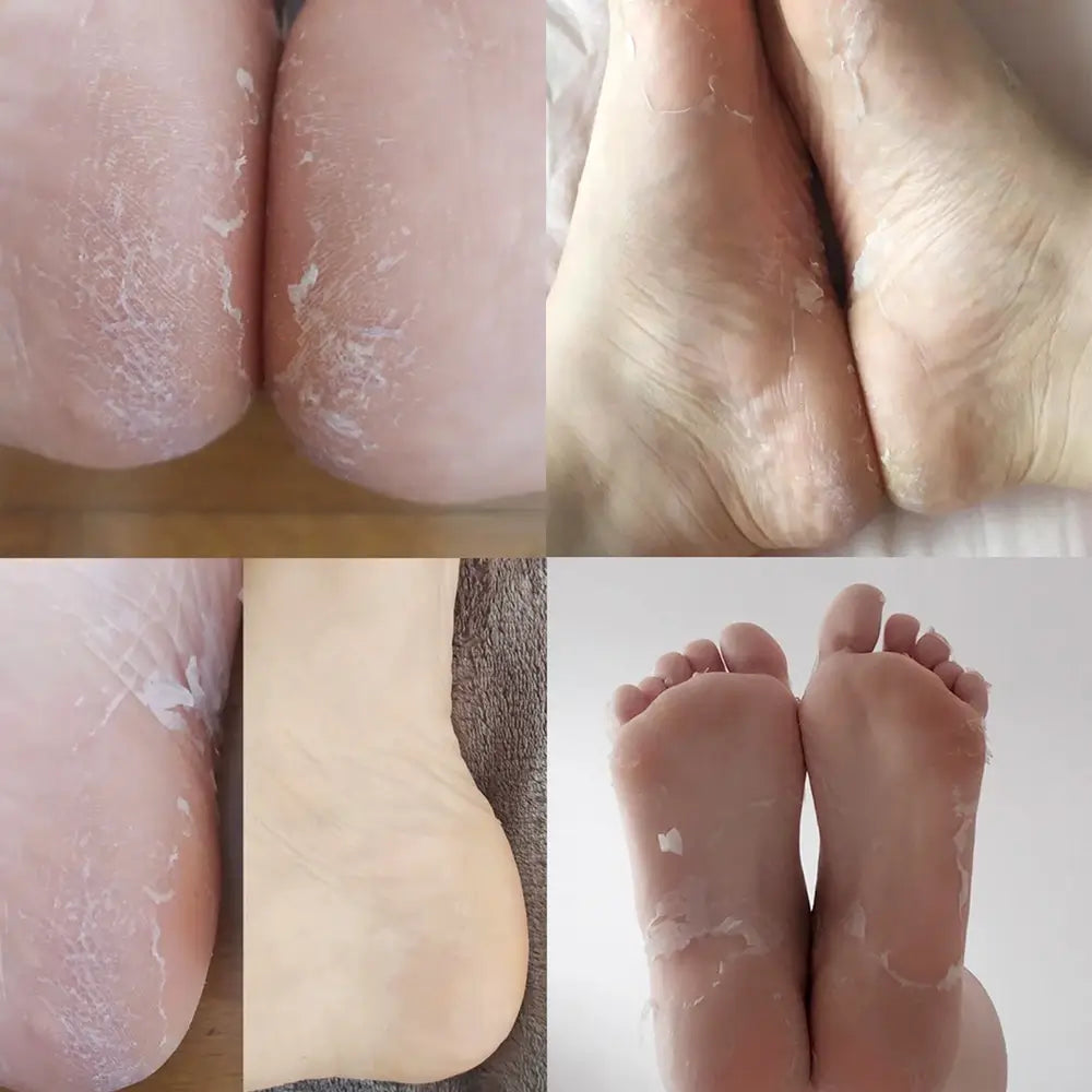 Masque gommant et exfoliant pour les chaussettes corporelles de Iroha Nature, 20 ml