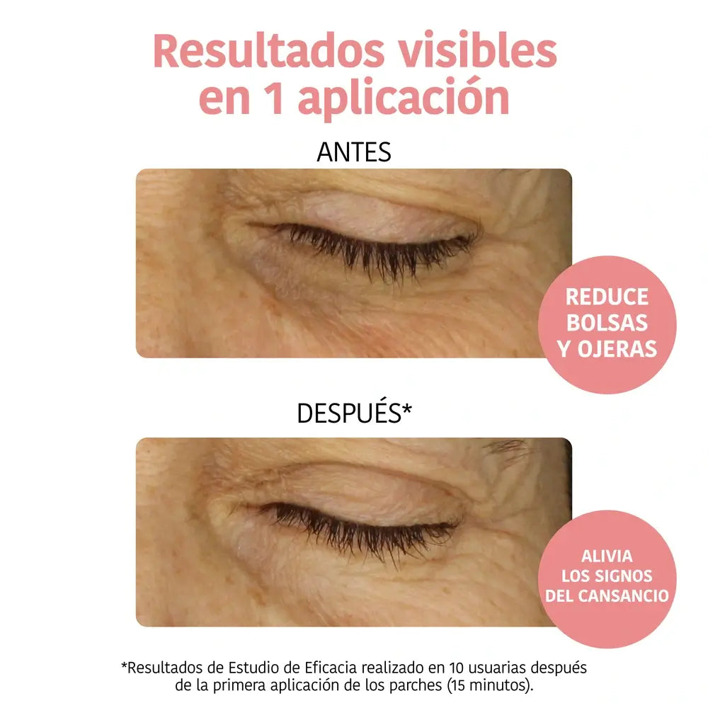 Iroha Nature Patchs anti-fatigue pour les yeux - Vitamine C , 16 (2x8) ml