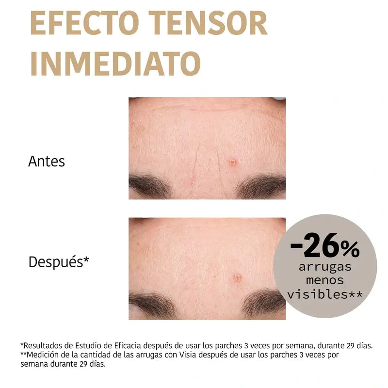 Iroha Nature Forehead Patches 99% Collagen (3 pcs + 1 Mist) , 3 paires