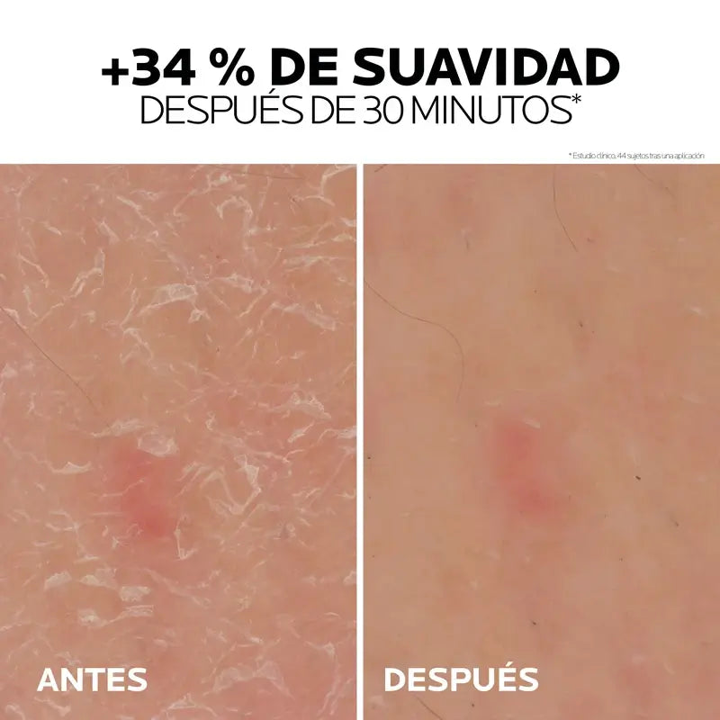 La Roche Posay Lipikar Urea Gel 30% - Gel hydratant à l'urée, 50 ml