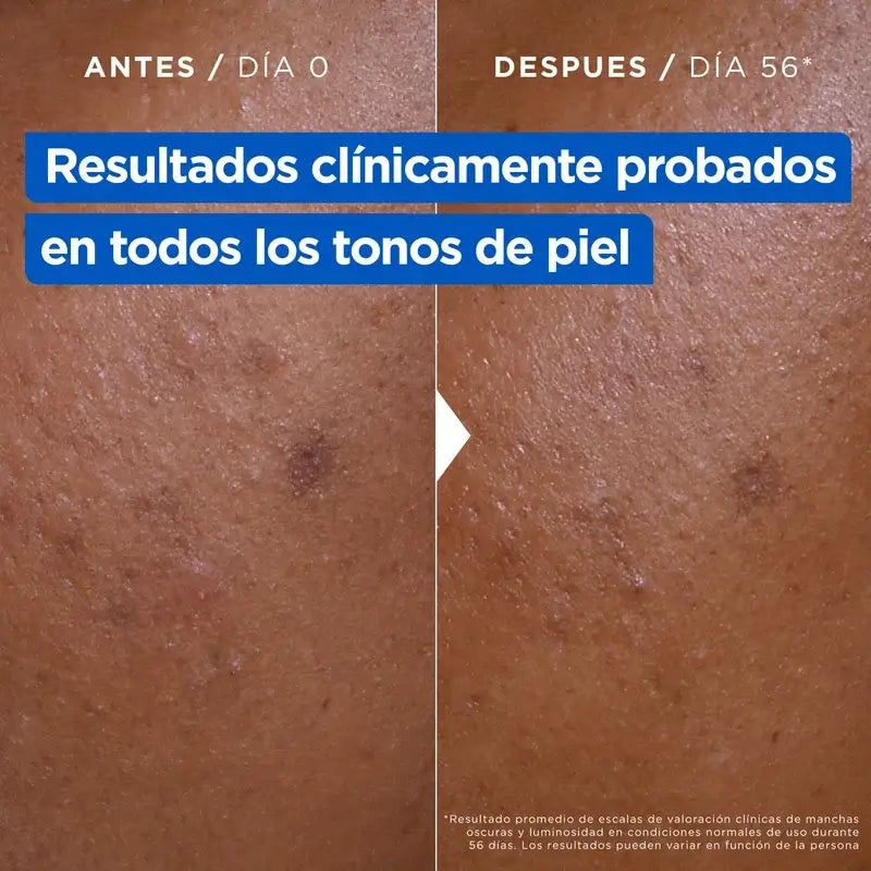 Mixa Crème anti-taches à la niacinamide, 400 ml