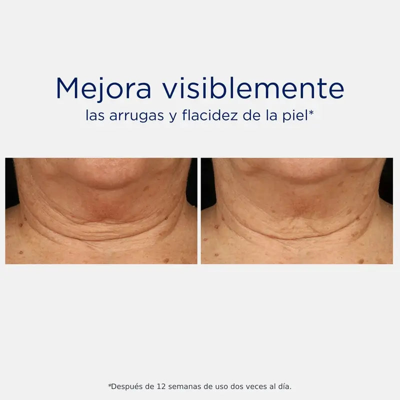Neostrata Skin Active Tri-Therapy Lifting Serum, sérum à l'acide hyaluronique 30ml