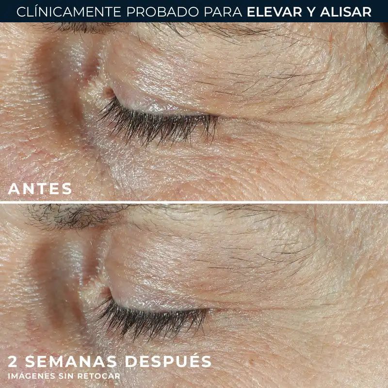 Roc Skincare Iberia Roc® Derm Correxion® Dual Eye 20Ml
