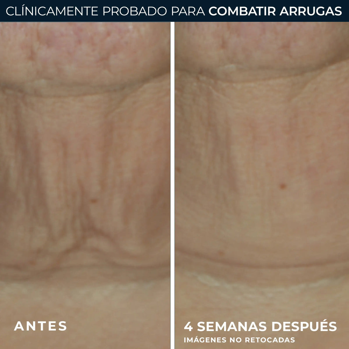 Roc Skincare Iberia Roc® Derm Correxion® Firming Stick 30G