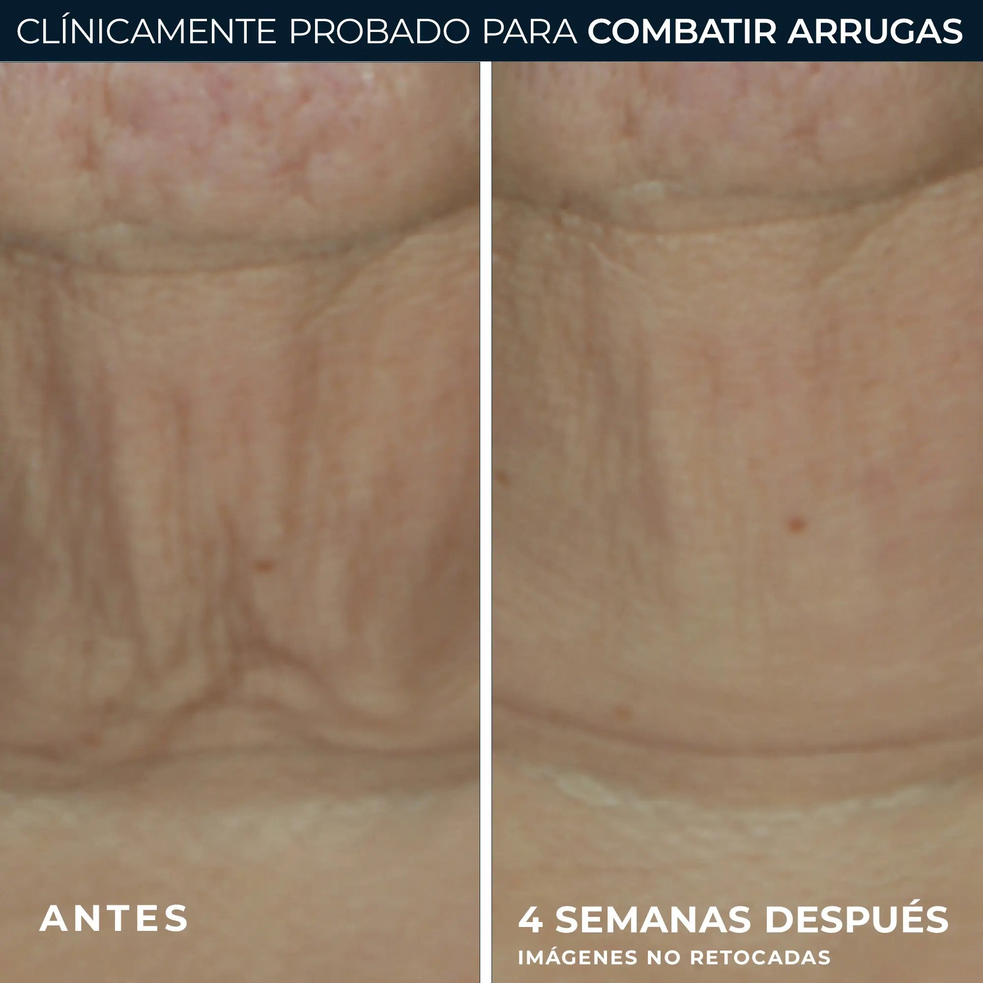 Roc Skincare Iberia Roc® Derm Correxion® Firming Stick 30G