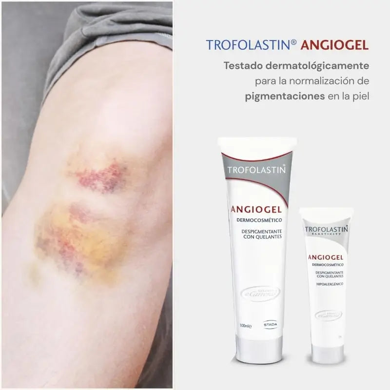 Trofolastin Angiogel Crème dépigmentante 100 Ml