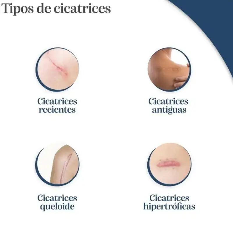 Trofolastin Réducteur de cicatrices, paquet de 2 x 10X14 Cm
