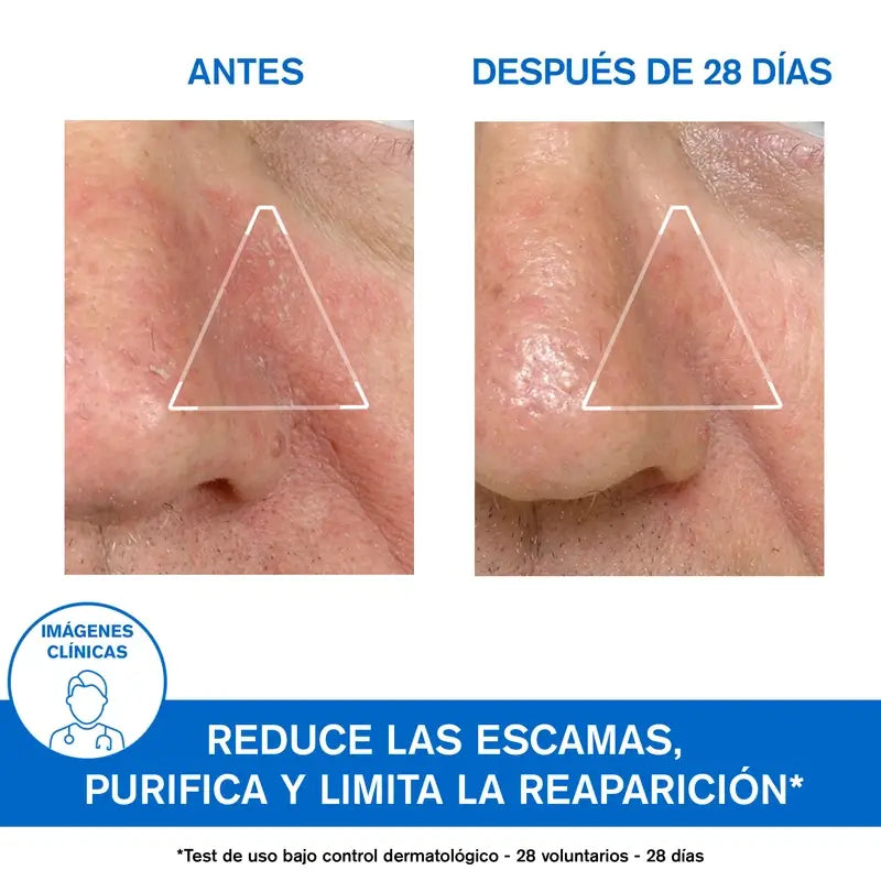 Uriage Ds Emulsion Apaisante 40Ml Non Parfumée